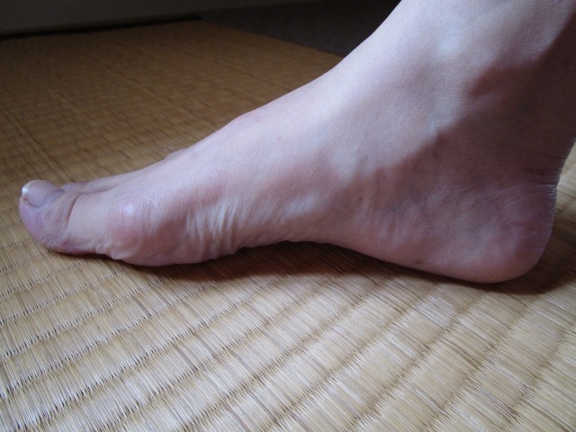 足のアーチ 
